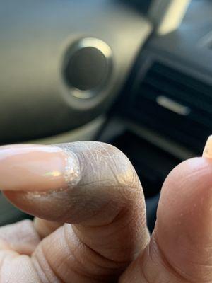 Extra gel hardened on cuticle