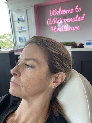 Facial rejuvenation and amazing new updated location