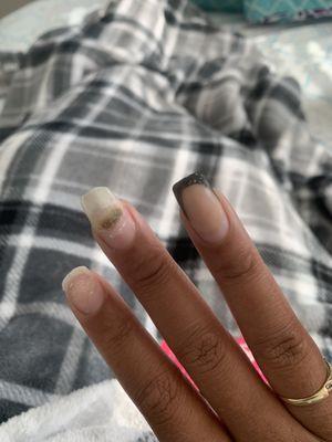 Fungus from Veretian Nail Salon