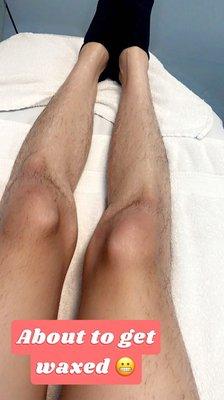 Before Leg Waxing