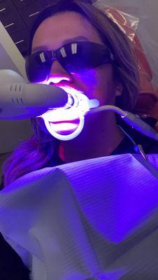 Teeth Whitening was a pretty cool experience! Highly recommend!