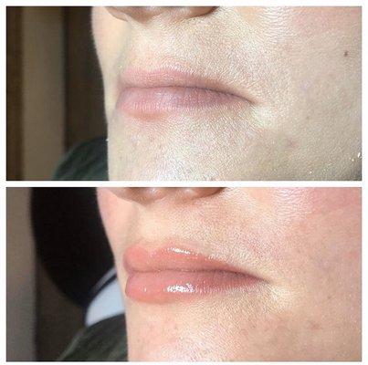 Lip blush before & after