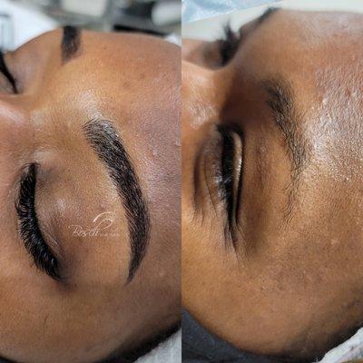 Microblading before and after