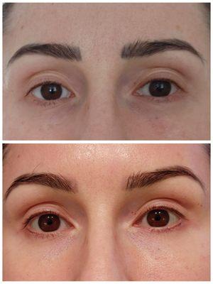 Eyebrow tattoo correction and lash enhancement