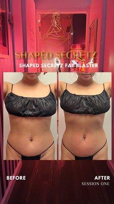 Shaped Secretz Body Sculpting