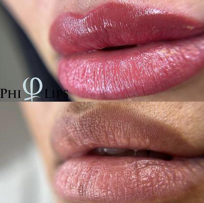 Before & After Lip Blushing by Corina