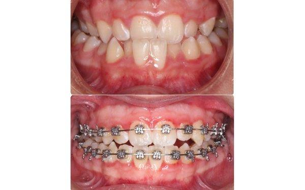 Before & after, miracles do happen thanks to Dr. K!