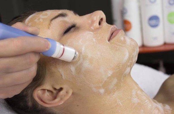 Bio-Brasion Trinity - Wet/Dry Microdermabrasion.