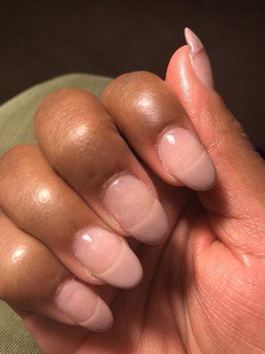 cuticle areas look horrible