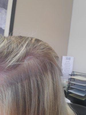 Bad highlights.  She didn't get to the root in several spot.