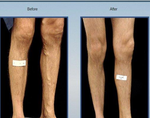 Before and after photos from actual patient