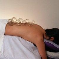 Cupping is a traditional way of improving circulation and releasing pathogens.