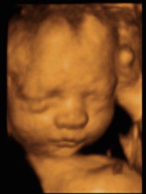 Pouty little one!  Imaging Miracles  417-861-0071