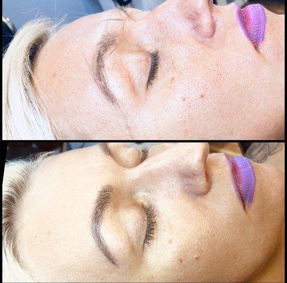 MICROBLADING Before & After