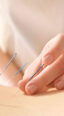 Acupuncture Needling by Dr. Mikiko Murakami