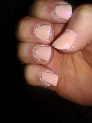 Nails