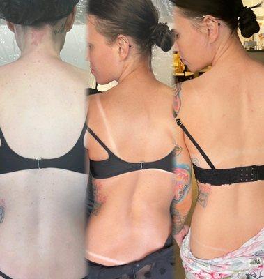 Spray tanning  before and after