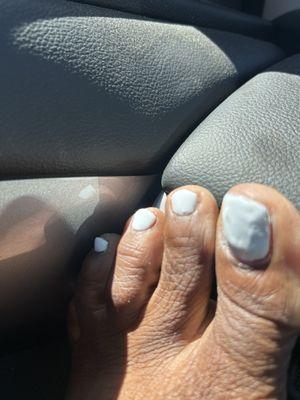 Very bad gel pedicure job :(