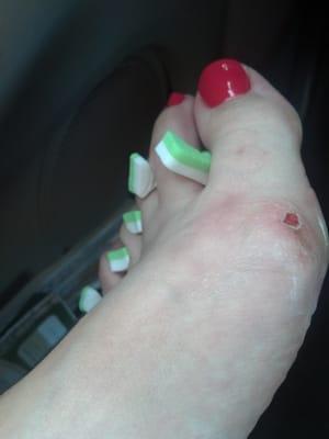 Failed pedicure at Cathy Nails