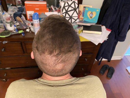 another view of the shitty haircut