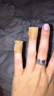 two bandages since im unable to use my fingers and the middle finger has a bacterial infection from them since they dont clean their tools.