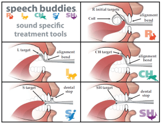 How Speech Buddies work inside the mouth.