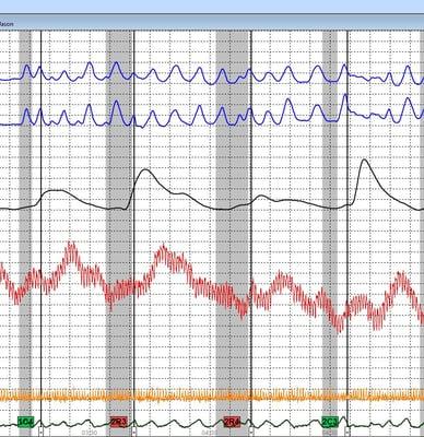 JNE Polygraph