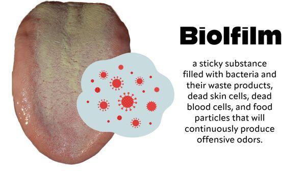 The source of oral bad breath is biofilm. The National Breath Center's Tongue Rejuvenation removes all biofilm.