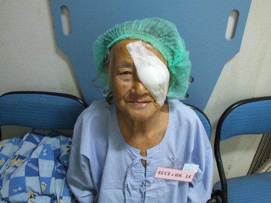 Patient in Thailand post cataract surgery (during Dr. Haines annual cataract removal mission to Asia)