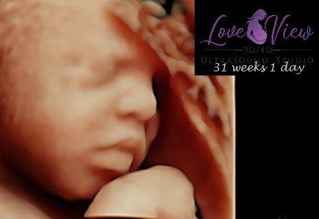 Love View 3d 4d ultrasound studio