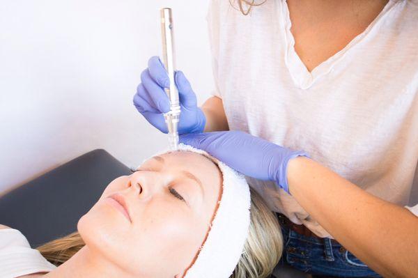 Collagen Induction Therapy tightens and toned the skins appearance with very little down time, call for specials and package deals.