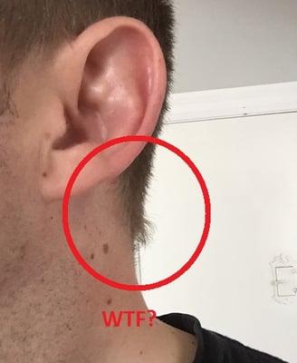 She also missed above both of my ears and shaved the sides and back way too high.