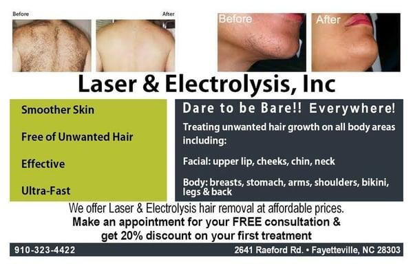 Permanent hair removal services.