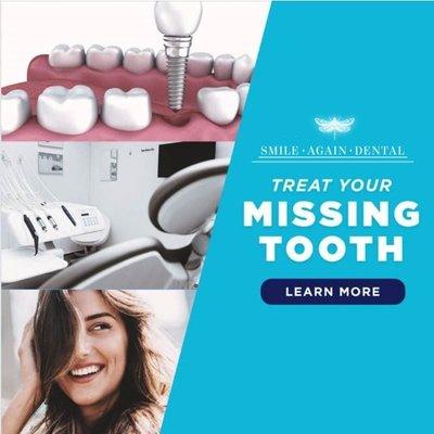 Dealing with a missing tooth can be stressful. When it comes to fixing a missing tooth, you want a dentist you can count on.