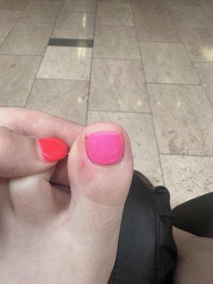 Cut skin, streaking, uneven cutting of nail