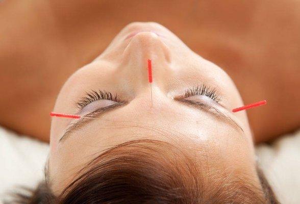 Very thin, tiny needles balance your body naturally.