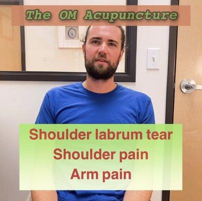 Acupuncture for Shoulder tear, Shoulder pain, Arm Pain