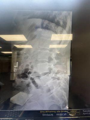 My clear xray he deemed unnecessary to look at