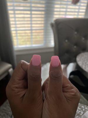 Right thumb nail is leaning to the left crooked