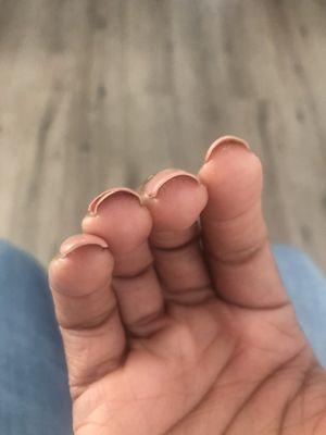 Gel lifting on two fingers after 5 days