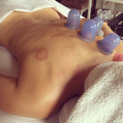 Massage cupping