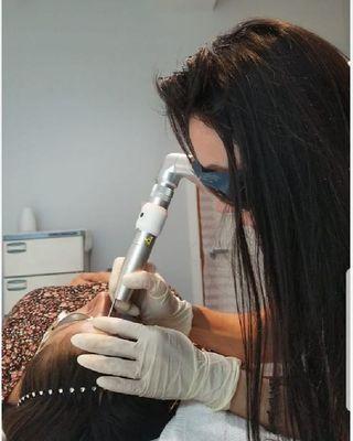 Eyebrow laser tattoo removal