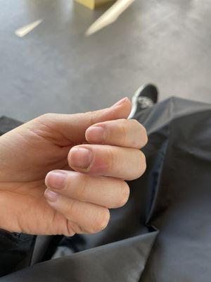 Finger nail