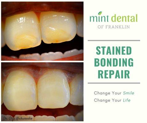 Stained Bonding Repair