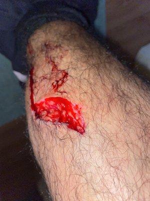 My leg