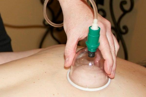 Cupping Massage