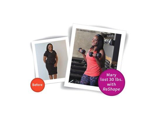 Mary lost 30 pounds with ReShape