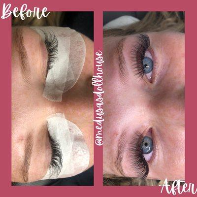 Before and After a Refill using 3D volume eyelash extensions, using extensions that have 3 lashes to give a more voluminous natural look.