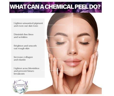 Chemical peels facial