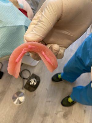 Dr. Yoo demonstrating how to apply denture glue for patient's family to understand.